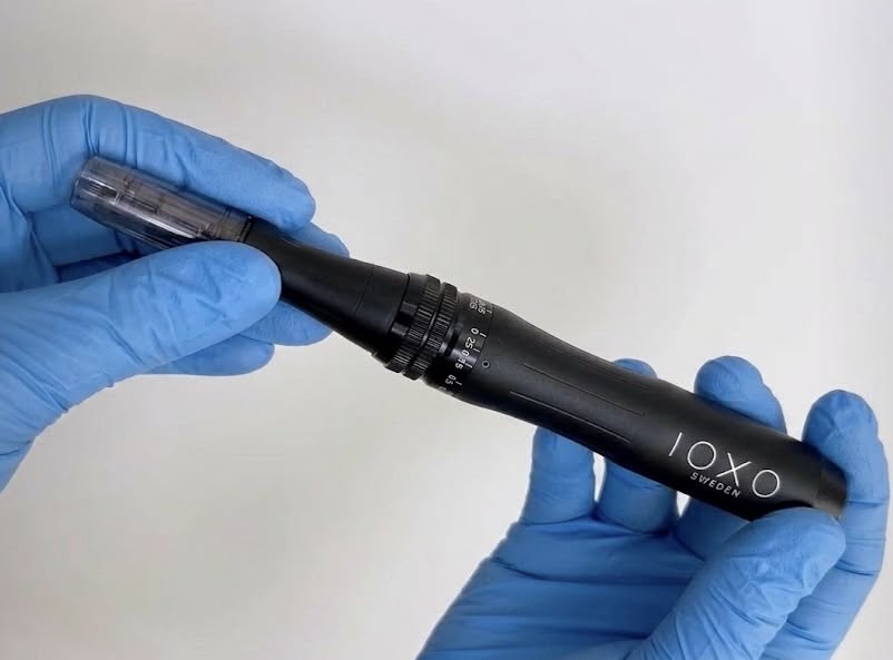 Microneedling